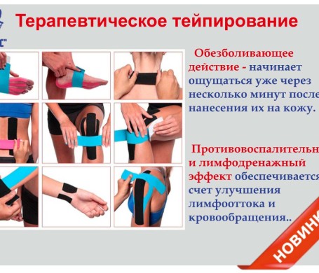 Тейпирование ортопедической мастерской ОРТОС Севастополь